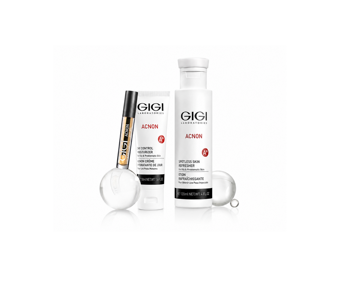 GIGIEU