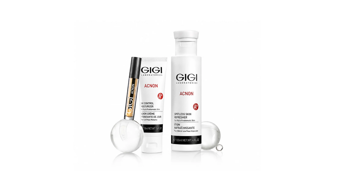 GIGIEU